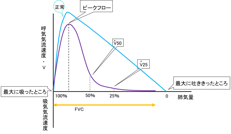 Flow-volume curve　2